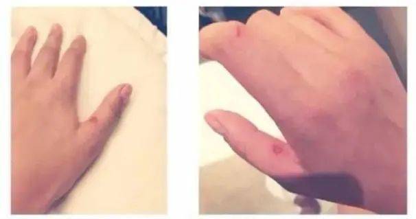 女子肩胛骨靈活到能夾死蒼蠅