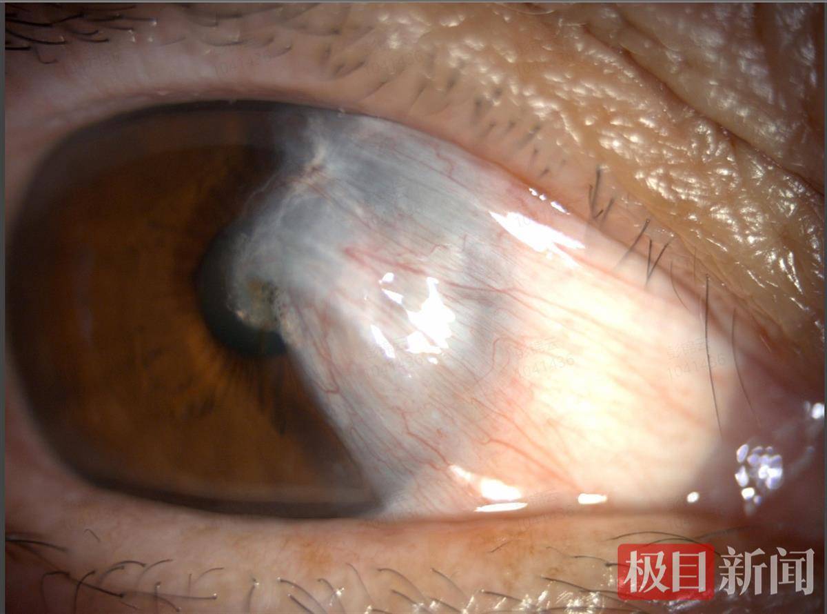 眼球缺失盲人辦卡被要求睜眼認(rèn)證