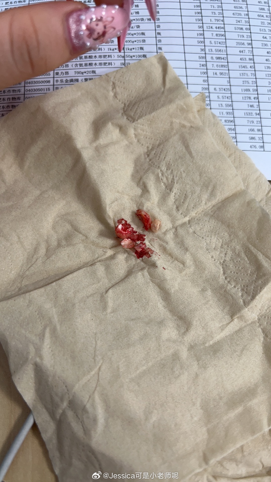 拔智齒后坐飛機爆血