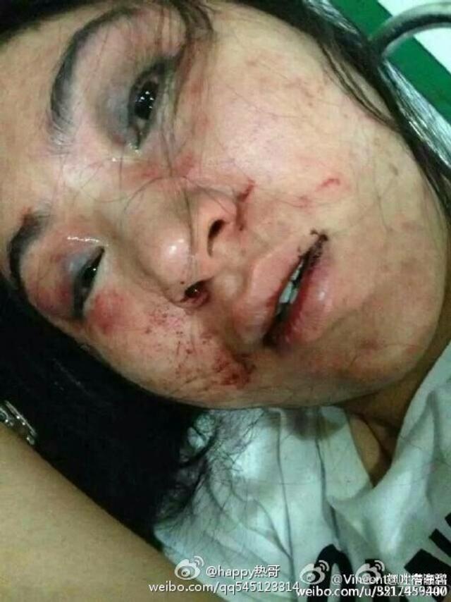 女老板被醉酒顧客打后還擊改判無罪