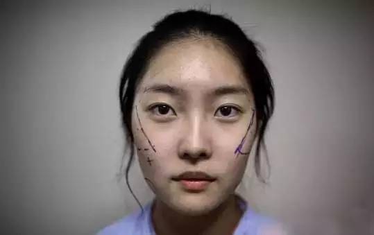 "想變韓女全臉整容"成風(fēng)潮？揭秘背后的風(fēng)險(xiǎn)與真相！